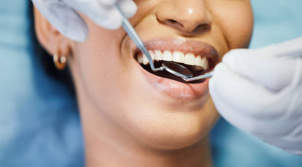 Best Emergency Dental Care for Broken or Chipped Teeth in Leonardtown, MD